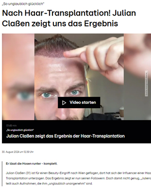 Juliencos Haartransplantation auf rtl.de